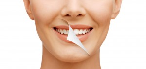 Tooth Whitening